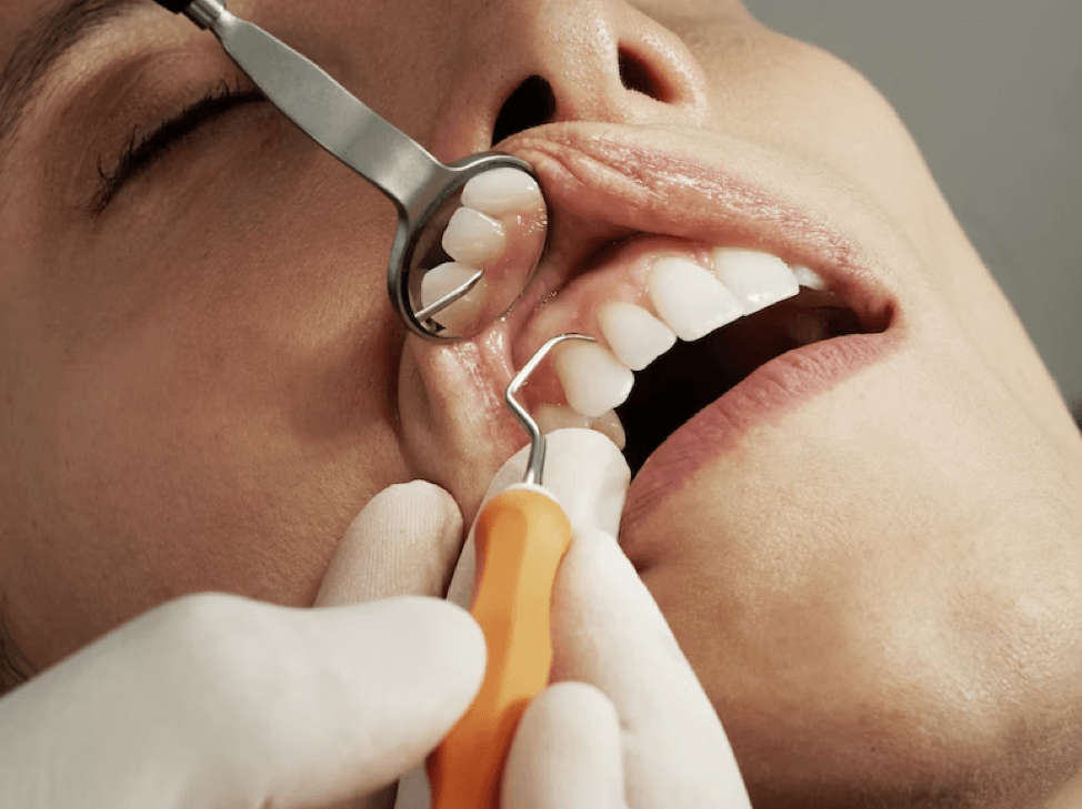 Dental Checkups Can Save You Money